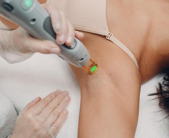 Die optimale Methode zur permanenten Haarentfernung.